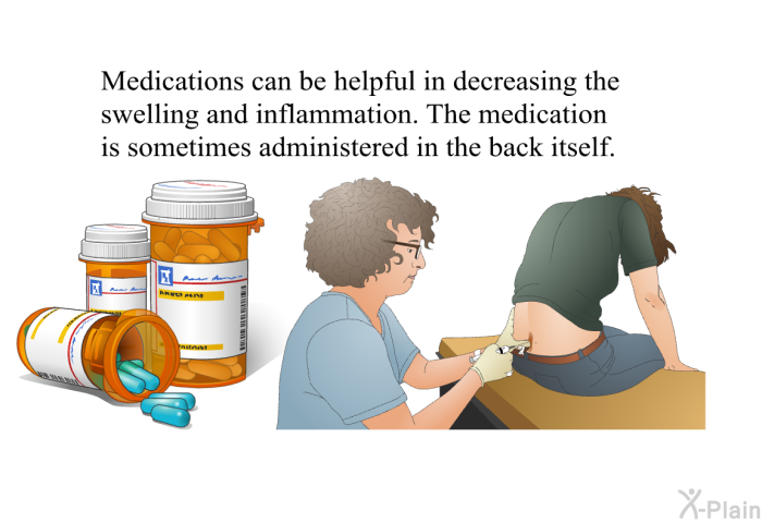 Medications can be helpful in decreasing the swelling and inflammation. The medication is sometimes administered in the back itself.