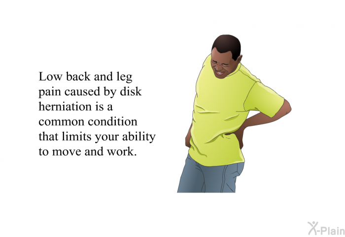 Low back and leg pain caused by disk herniation is a common condition that limits your ability to move and work.