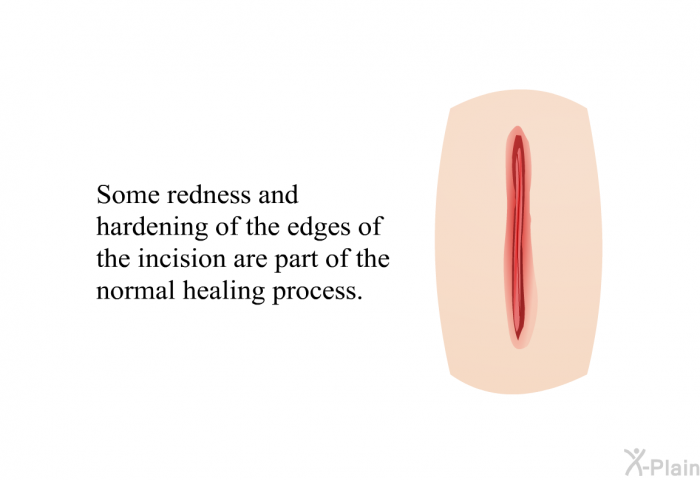 Some redness and hardening of the edges of the incision are part of the normal healing process.