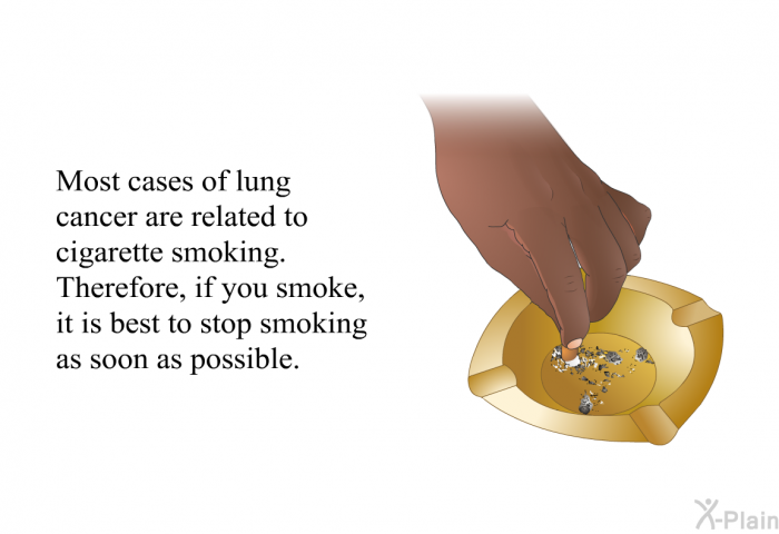 Most cases of lung cancer are related to cigarette smoking. Therefore, if you smoke, it is best to stop smoking as soon as possible.