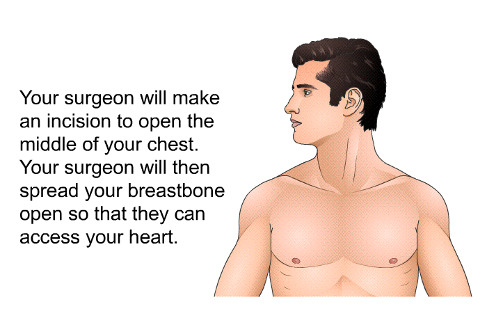 Your surgeon will make an incision to open the middle of your chest. Your surgeon will then spread your breastbone open so that they can access your heart.