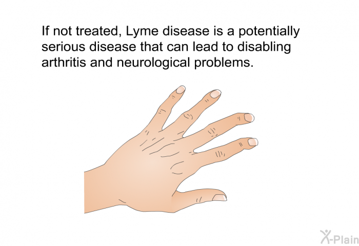 If not treated, Lyme disease is a potentially serious disease that can lead to disabling arthritis and neurological problems.