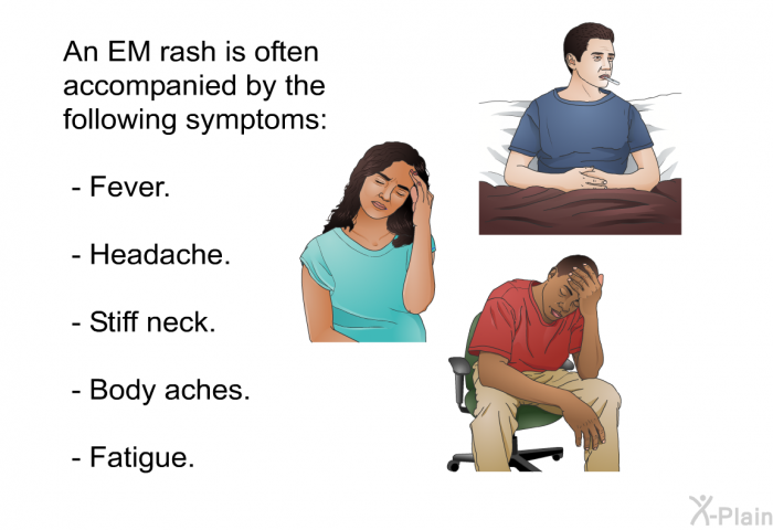 An EM rash is often accompanied by the following symptoms:  Fever. Headache. Stiff neck. Body aches. Fatigue.