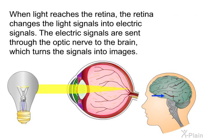 When light reaches the retina, the retina changes the light signals into electric signals. The electric signals are sent through the optic nerve to the brain, which turns the signals into images.