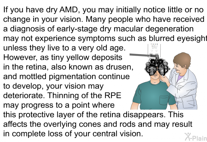 If you have dry AMD, you may initially notice little or no change in your vision. Many people who have received a diagnosis of early-stage dry macular degeneration may not experience symptoms such as blurred eyesight unless they live to a very old age. However, as tiny yellow deposits in the retina, also known as drusen, and mottled pigmentation continue to develop, your vision may deteriorate. Thinning of the RPE may progress to a point where this protective layer of the retina disappears. This affects the overlying cones and rods and may result in complete loss of your central vision.