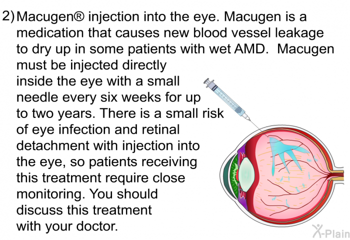 Macugen  injection into the eye. Macugen is a medication that causes new blood vessel leakage to dry up in some patients with wet AMD. Macugen must be injected directly inside the eye with a small needle every six weeks for up to two years. There is a small risk of eye infection and retinal detachment with injection into the eye, so patients receiving this treatment require close monitoring. You should discuss this treatment with your doctor.