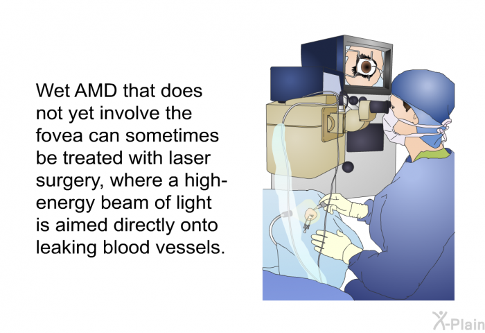 Wet AMD that does not yet involve the fovea can sometimes be treated with laser surgery, where a high-energy beam of light is aimed directly onto leaking blood vessels.
