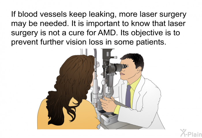 If blood vessels keep leaking, more laser surgery may be needed. It is important to know that laser surgery is not a cure for AMD. Its objective is to prevent further vision loss in some patients.