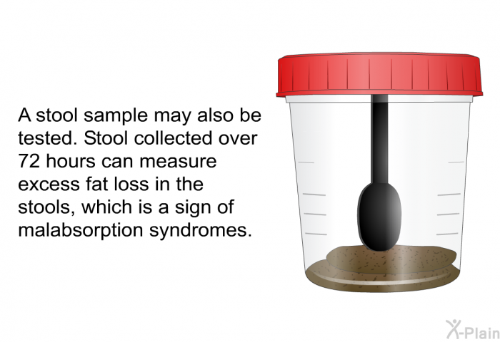 A stool sample may also be tested. Stool collected over 72 hours can measure excess fat loss in the stools, which is a sign of malabsorption syndromes.