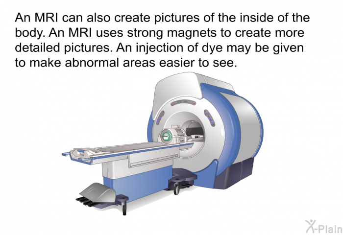 An MRI can also create pictures of the inside of the body. An MRI uses strong magnets to create more detailed pictures. An injection of dye may be given to make abnormal areas easier to see.