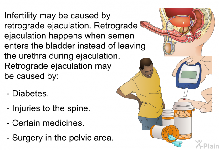 Infertility may be caused by retrograde ejaculation. Retrograde ejaculation happens when semen enters the bladder instead of leaving the urethra during ejaculation. Retrograde ejaculation may be caused by:  Diabetes. Injuries to the spine. Certain medicines. Surgery in the pelvic area.
