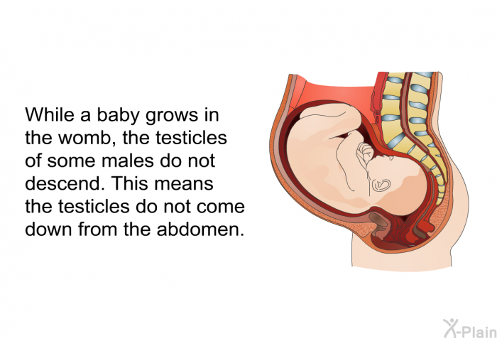 While a baby grows in the womb, the testicles of some males do not descend. This means the testicles do not come down from the abdomen.