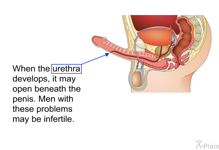 When the urethra develops, it may open beneath the penis. Men with these problems may be infertile.