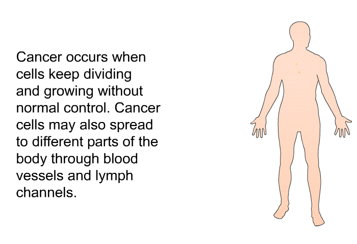 Cancer occurs when cells keep dividing and growing without normal control. Cancer cells may also spread to different parts of the body through blood vessels and lymph channels.