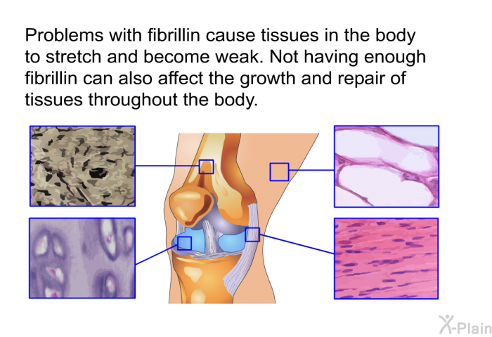 Problems with fibrillin cause tissues in the body to stretch and become weak. Not having enough fibrillin can also affect the growth and repair of tissues throughout the body.