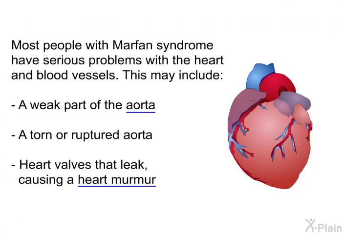 Most people with Marfan syndrome have serious problems with the heart and blood vessels. This may include:  A weak part of the aorta A torn or ruptured aorta Heart valves that leak, causing a heart murmur