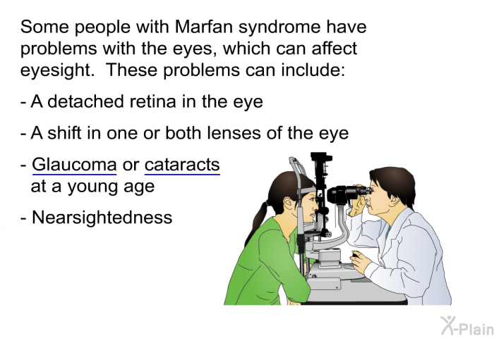 Some people with Marfan syndrome have problems with the eyes, which can affect eyesight. These problems can include:  A detached retina in the eye A shift in one or both lenses of the eye Glaucoma or cataracts at a young age Nearsightedness