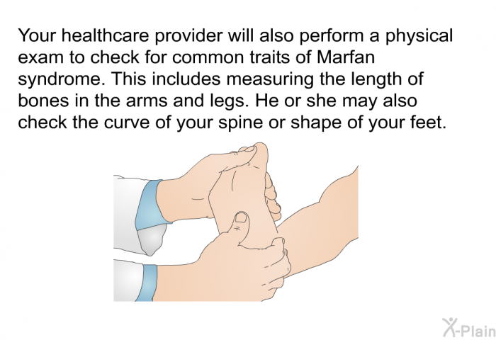 Your healthcare provider will also perform a physical exam to check for common traits of Marfan syndrome. This includes measuring the length of bones in the arms and legs. He or she may also check the curve of your spine or shape of your feet.
