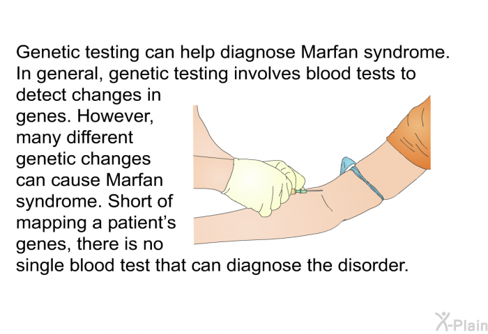 Genetic testing can help diagnose Marfan syndrome. In general, genetic testing involves blood tests to detect changes in genes. However, many different genetic changes can cause Marfan syndrome. Short of mapping a patient's genes, there is no single blood test can diagnose the disorder.