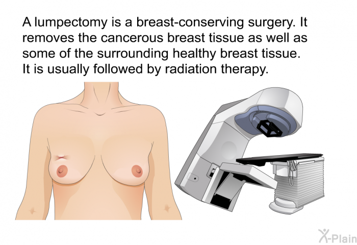 A lumpectomy is a breast-conserving surgery. It removes the cancerous breast tissue as well as some of the surrounding healthy breast tissue. It is usually followed by radiation therapy.