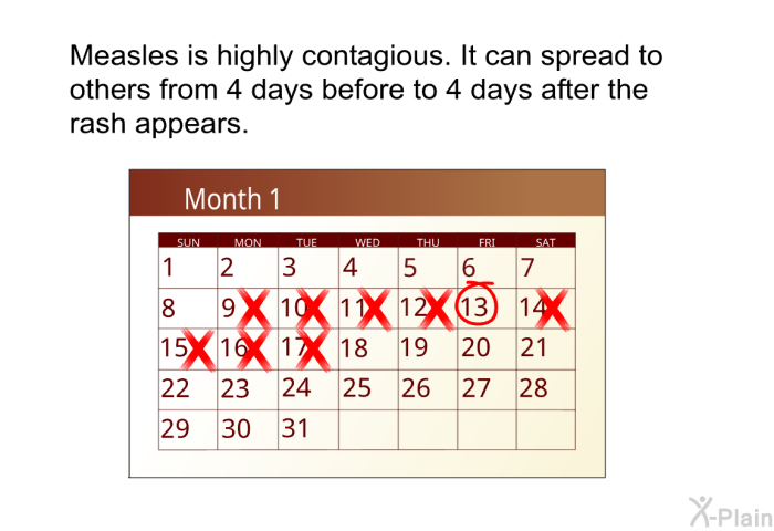 Measles is highly contagious. It can spread to others from 4 days before to 4 days after the rash appears.