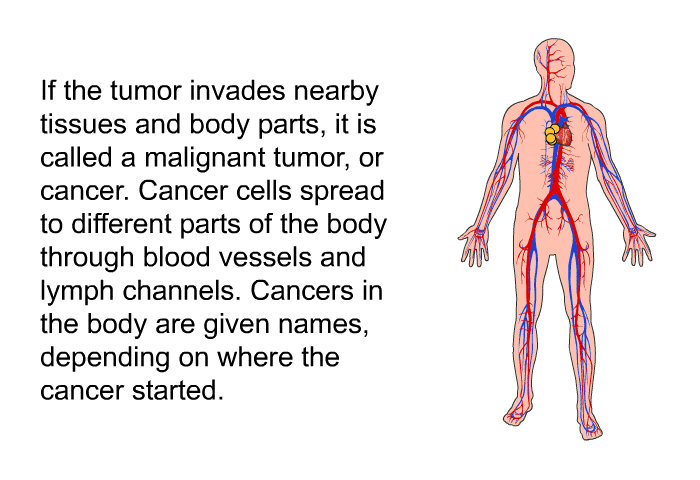 If the tumor invades nearby tissues and body parts, it is called a malignant tumor, or cancer. Cancer cells spread to different parts of the body through blood vessels and lymph channels. Cancers in the body are given names, depending on where the cancer started.