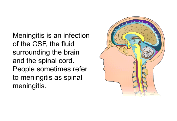 Meningitis is an infection of the CSF, the fluid surrounding the brain and the spinal cord. People sometimes refer to meningitis as spinal meningitis.