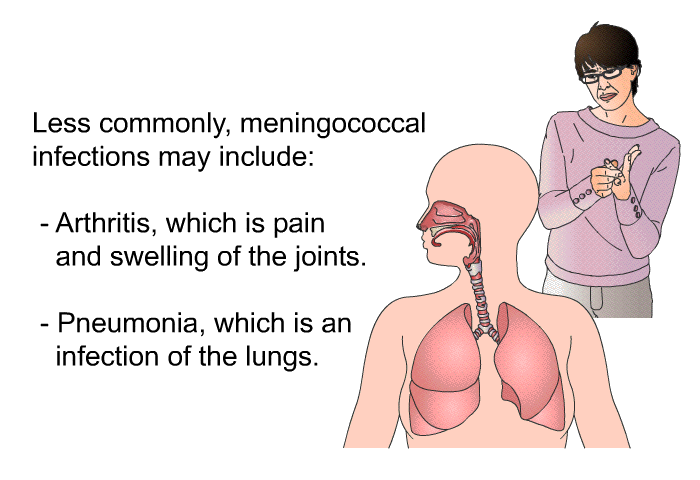 Less commonly, meningococcal infections may include:  Arthritis, which is pain and swelling of the joints. Pneumonia, which is an infection of the lungs.