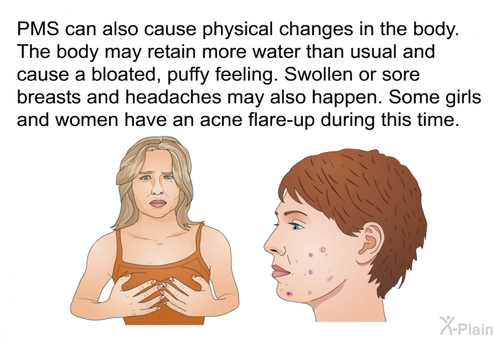 PMS can also cause physical changes in the body. The body may retain more water than usual and cause a bloated, puffy feeling. Swollen or sore breasts and headaches may also happen. Some girls and women have an acne flare-up during this time.