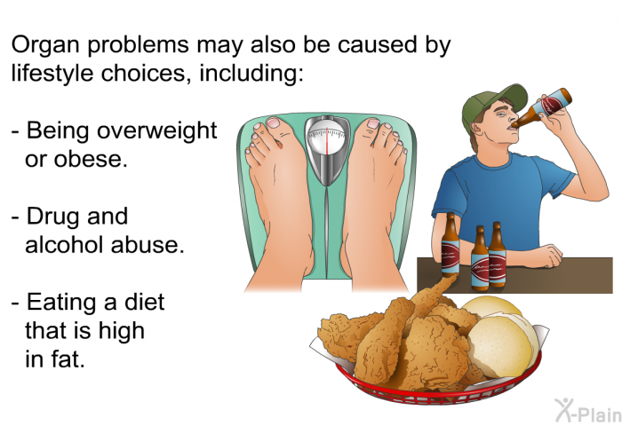 Organ problems may also be caused by lifestyle choices, including:  Being overweight or obese. Drug and alcohol abuse. Eating a diet that is high in fat.