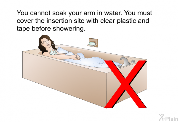 You cannot soak your arm in water. You must cover the insertion site with clear plastic and tape before showering.