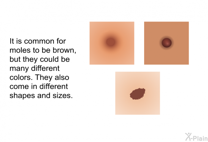 It is common for moles to be brown, but they could be many different colors. They also come in different shapes and sizes.