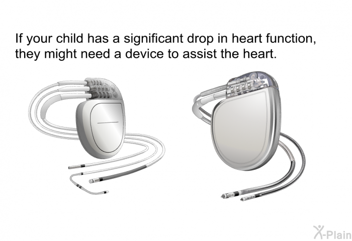 If your child has a significant drop in heart function, they might need a device to assist the heart.