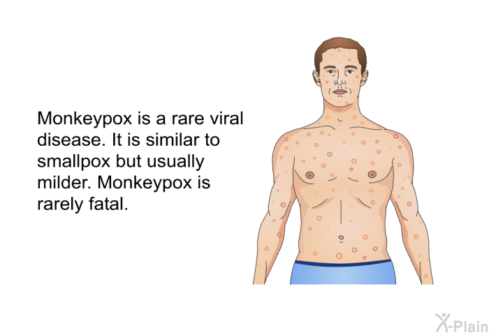 Monkeypox is a rare viral disease. It is similar to smallpox but usually milder. Monkeypox is rarely fatal.