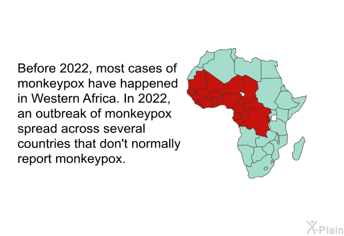 Before 2022, most cases of monkeypox have happened in Western Africa. In 2022, an outbreak of monkeypox spread across several countries that don't normally report monkeypox. 