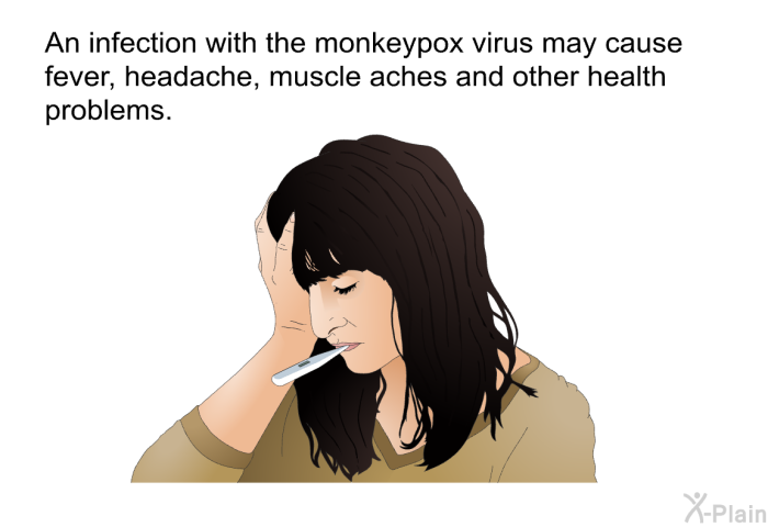 An infection with the monkeypox virus may cause fever, headache, muscle aches and other health problems.