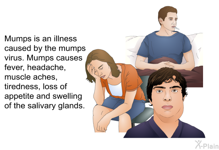 Mumps is an illness caused by the mumps virus. Mumps causes fever, headache, muscle aches, tiredness, loss of appetite and swelling of the salivary glands.