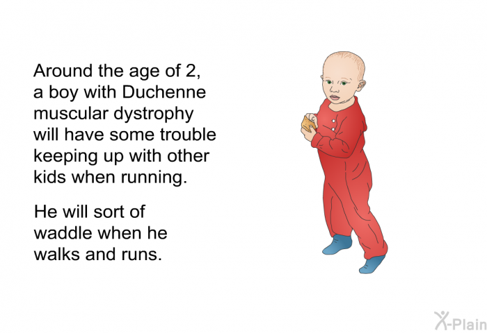 Around the age of 2, a boy with Duchenne muscular dystrophy will have some trouble keeping up with other kids when running. He will sort of waddle when he walks and runs.