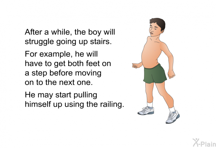 After a while, the boy will struggle going up stairs. For example, he will have to get both feet on a step before moving on to the next one. He may start pulling himself up using the railing.