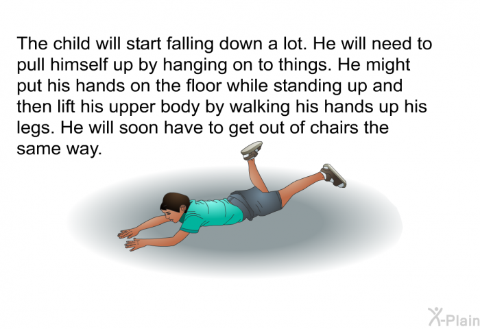 The child will start falling down a lot. He will need to pull himself up by hanging on to things. He might put his hands on the floor while standing up and then lift his upper body by walking his hands up his legs. He will soon have to get out of chairs the same way.