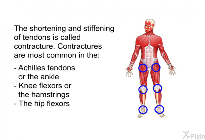 The shortening and stiffening of tendons is called contracture. Contractures are most common in the:  Achilles tendons or the ankle Knee flexors or the hamstrings The hip flexors