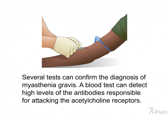 Several tests can confirm the diagnosis of myasthenia gravis. A blood test can detect high levels of the antibodies responsible for attacking the acetylcholine receptors.
