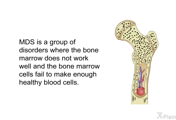 MDS is a group of disorders where the bone marrow does not work well and the bone marrow cells fail to make enough healthy blood cells.