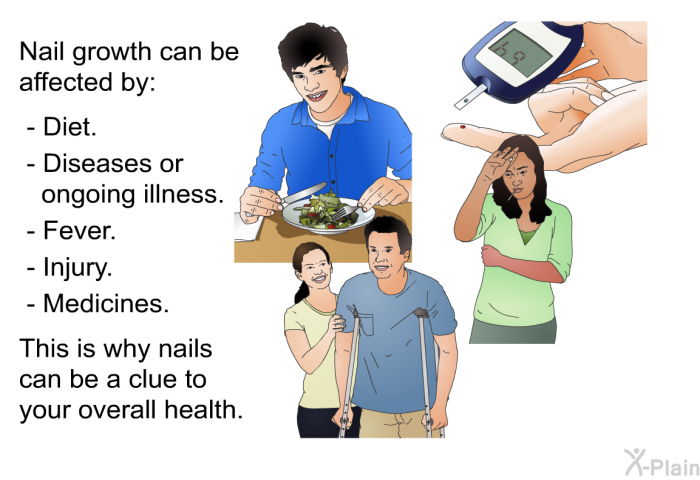 Nail growth can be affected by:  Diet. Diseases or ongoing illness. Fever. Injury. Medicines.  
 This is why nails can be a clue to your overall health.