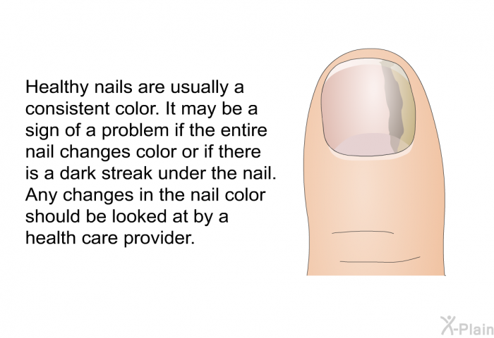 Healthy nails are usually a consistent color. It may be a sign of a problem if the entire nail changes color or if there is a dark streak under the nail. Any changes in the nail color should be looked at by a health care provider.