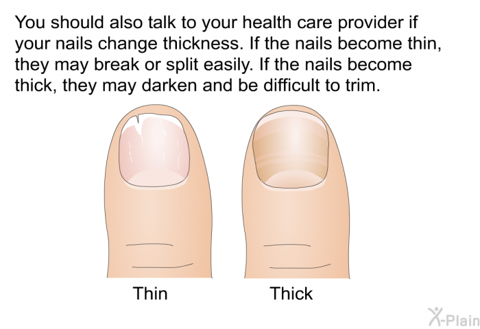 You should also talk to your health care provider if your nails change thickness. If the nails become thin, they may break or split easily. If the nails become thick, they may darken and be difficult to trim.
