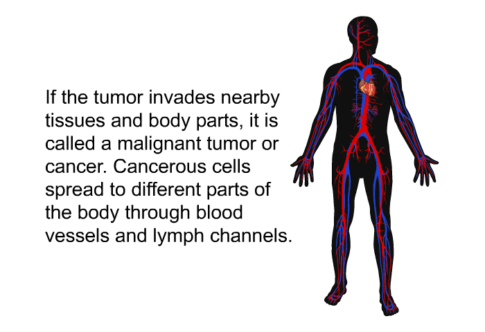 If the tumor invades nearby tissues and body parts, it is called a malignant tumor or cancer. Cancerous cells spread to different parts of the body through blood vessels and lymph channels.