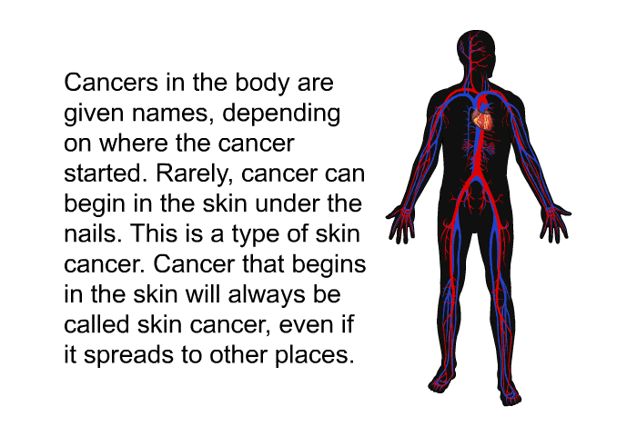 Cancers in the body are given names, depending on where the cancer started. Rarely, cancer can begin in the skin under the nails. This is a type of skin cancer. Cancer that begins in the skin will always be called skin cancer, even if it spreads to other places.