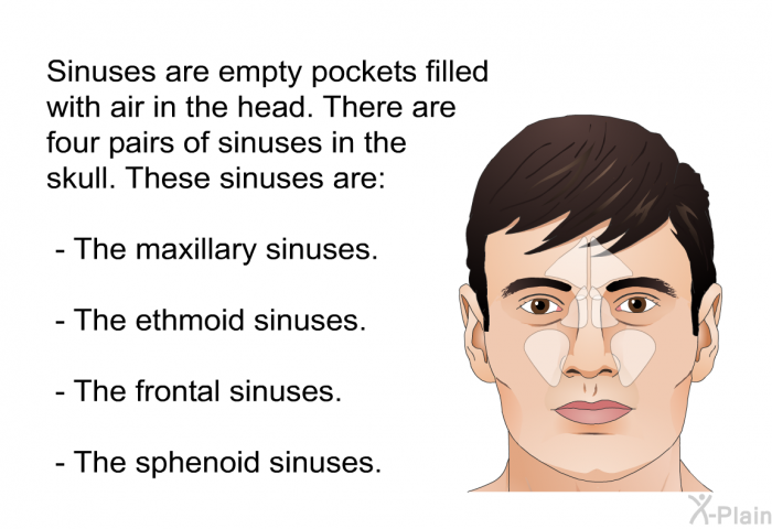 Sinuses are empty pockets filled with air in the head. There are four pairs of sinuses in the skull. These sinuses are:  The maxillary sinuses.  The ethmoid sinuses. The frontal sinuses. The sphenoid sinuses.