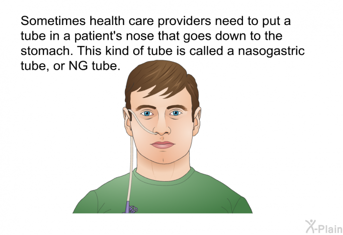 Sometimes health care providers need to put a tube in a patient's nose that goes down to the stomach. This kind of tube is called a nasogastric tube, or NG tube.